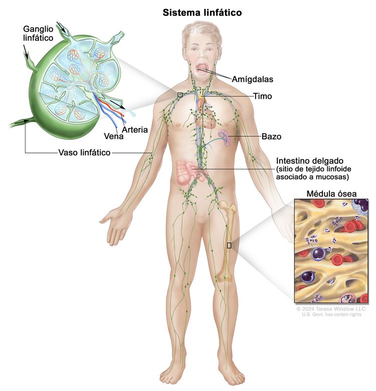 Sistema linfático. Dibujo de un hombre adulto en el que se observan los vasos y ganglios linfáticos del cuerpo y órganos del sistema linfático, como las amígdalas, el timo, el bazo y la médula ósea, así como el tejido linfoide asociado a mucosas que se encuentra en el intestino delgado. En la parte superior izquierda, se observa una ampliación de la estructura interna de un ganglio linfático con una arteria, una vena y vasos linfáticos con flechas que señalan la forma en que la linfa (líquido claro) entra y sale del ganglio linfático. En la parte inferior derecha, en una ampliación del hueso del muslo, se observa la médula ósea con células sanguíneas. Sistema linfático. Dibujo de un hombre adulto en el que se observan los vasos y ganglios linfáticos del cuerpo y órganos del sistema linfático, como las amígdalas, el timo, el bazo y la médula ósea, así como el tejido linfoide asociado a mucosas que se encuentra en el intestino delgado. En la parte superior izquierda, se observa una ampliación de la estructura interna de un ganglio linfático con una arteria, una vena y vasos linfáticos con flechas que señalan la forma en que la linfa (líquido claro) entra y sale del ganglio linfático. En la parte inferior derecha, en una ampliación del hueso del muslo, se observa la médula ósea con células sanguíneas.