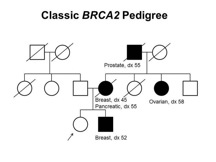 Pedigree showing some of the classic features of a family with a deleterious BRCA2 mutation across three generations, including transmission occurring through maternal and paternal lineages. The unaffected female proband is shown as having an affected brother (breast cancer diagnosed at age 52 y), mother (breast cancer diagnosed at age 45 y and pancreatic cancer diagnosed at age 55 y), maternal aunt (ovarian cancer diagnosed at age 58 y), and maternal grandfather (prostate cancer diagnosed at age 55 y). Pedigree showing some of the classic features of a family with a deleterious BRCA2 mutation across three generations, including transmission occurring through maternal and paternal lineages. The unaffected female proband is shown as having an affected brother (breast cancer diagnosed at age 52 y), mother (breast cancer diagnosed at age 45 y and pancreatic cancer diagnosed at age 55 y), maternal aunt (ovarian cancer diagnosed at age 58 y), and maternal grandfather (prostate cancer diagnosed at age 55 y).